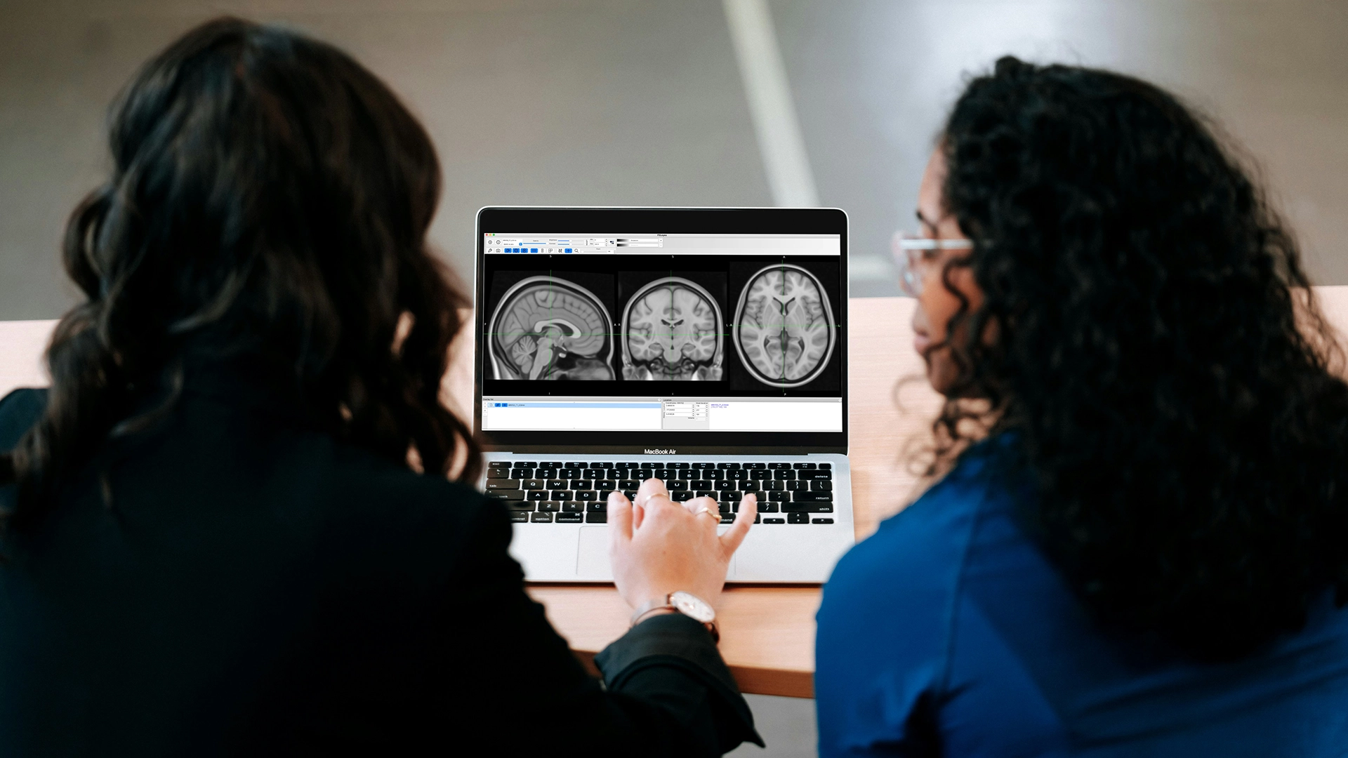 Novo Sistema de IA do MIT Torna a Segmenta&ccedil;&atilde;o de Imagens Mais R&aacute;pida e F&aacute;cil